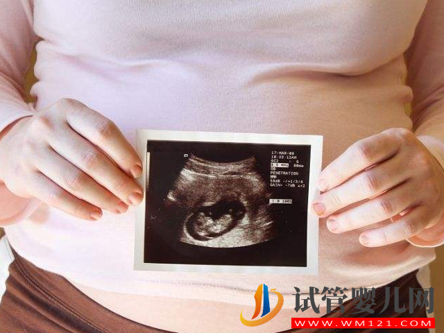 正規大醫院只做三維不做四維真相來了，真不是因為級別高低！(圖1)