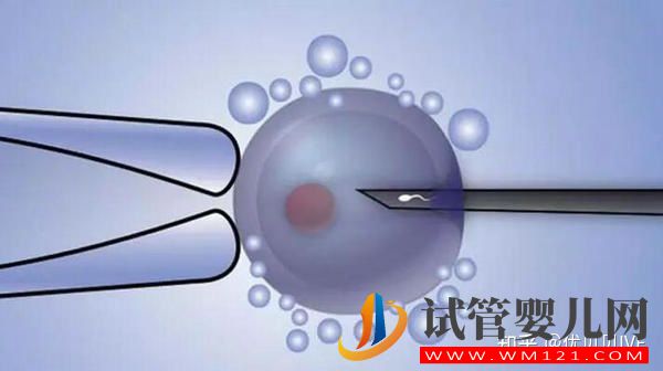 國(guó)內(nèi)排名靠前的三代試管醫(yī)院都有哪些_第一梯隊(duì)了解下(圖1)