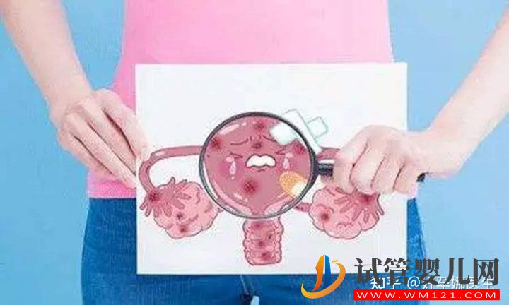 子宮內(nèi)膜異位到底是什么,有哪些癥狀_又該如何預(yù)防(圖3)