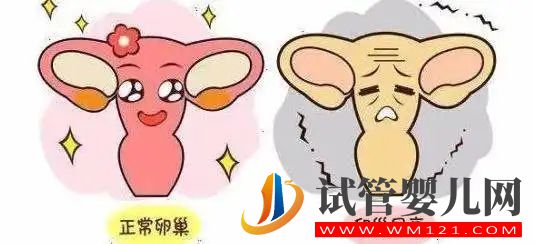 卵巢早衰更親睞哪些人？(圖1)