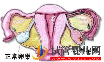 卵巢早衰有什么跡象(圖1)