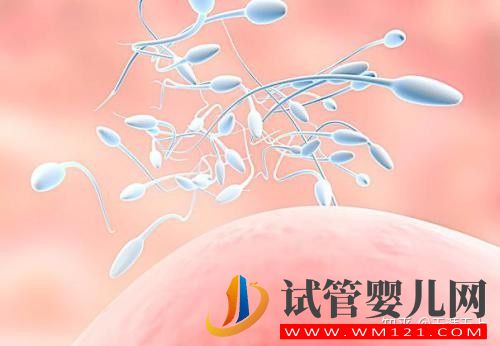 無精癥,需要進行哪些檢查(圖2)