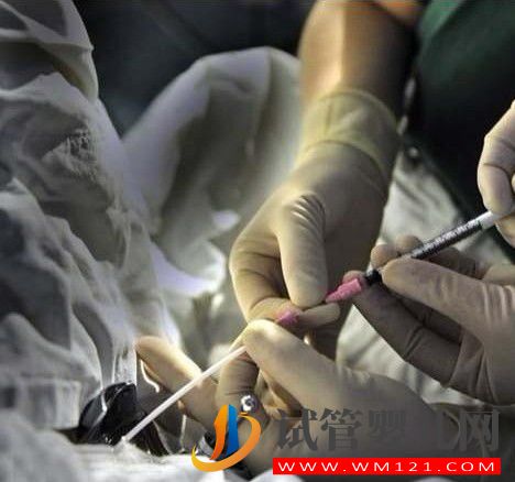 試管移植前后需要注意哪些方面(圖1)