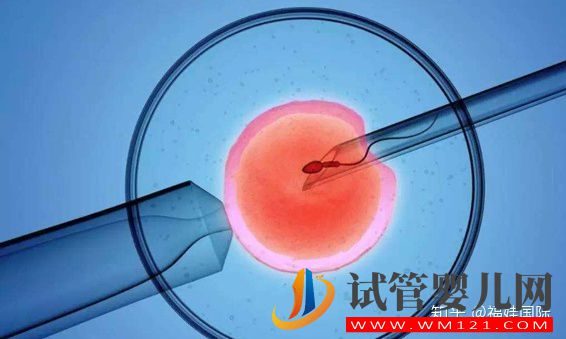 揭秘取卵全流程(附圖),腹部穿刺術(shù)只需10-20分鐘(圖2)