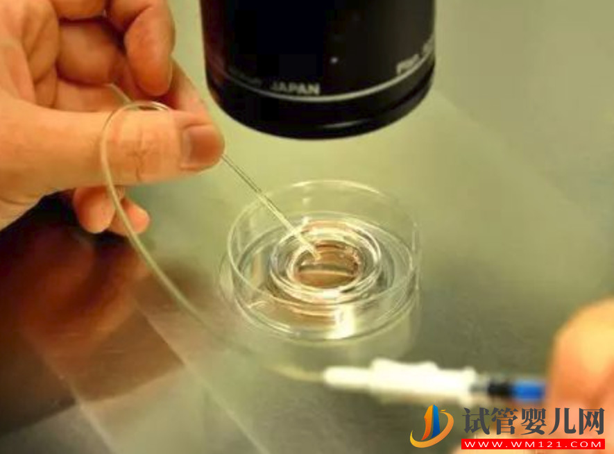 人工助孕養(yǎng)囊和移植該怎么選？5個(gè)因素決定囊胚培養(yǎng)成敗(圖1)