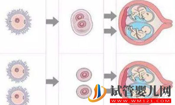 龍鳳胎是怎么形成的_龍鳳胎形成過程(圖2) 龍鳳胎是怎么形成的_龍鳳胎形成過程(圖2)