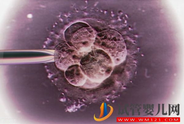 細數日本人工授精費用，醫療、生活與國內差別竟如此(圖2)
