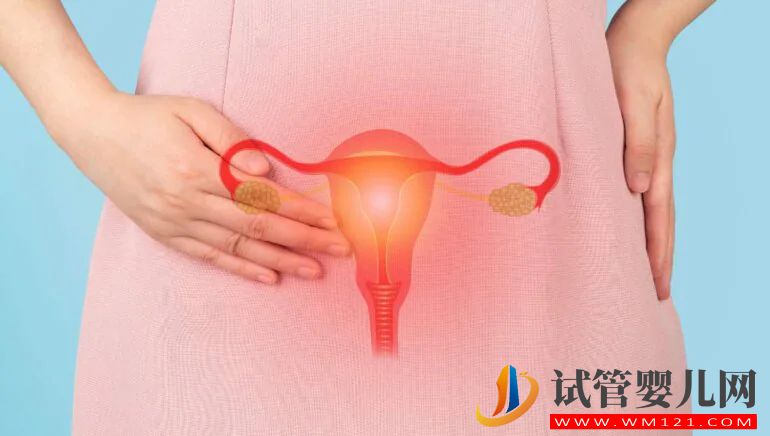 子宮內膜異位癥的自我護理技巧(圖1)