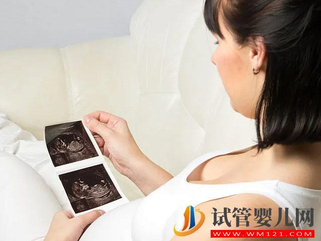 四維彩超男女參照圖對比，一看有這個特征是男寶幾率最大(圖1)