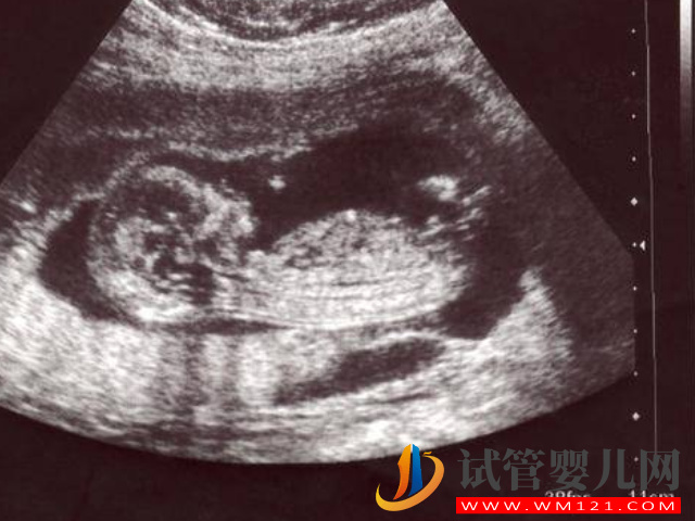 廣豐婦幼保健院四維彩超預約攻略，線上預約從容產檢更安心(圖1)