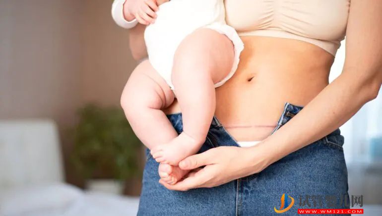 了解剖腹產對母嬰的副作用(圖1)