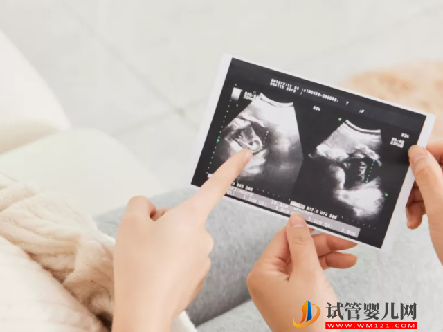 民間最靈預(yù)測生男生女方法大揭秘,舉例說明包教你看懂!(圖3) 民間最靈預(yù)測生男生女方法大揭秘,舉例說明包教你看懂!(圖3)