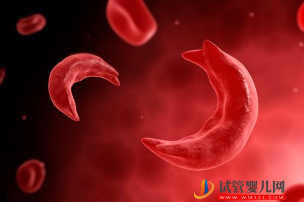 地中海貧血要做幾代試管，醫(yī)生：這2種情況才適合別搞錯(cuò)了(圖2)