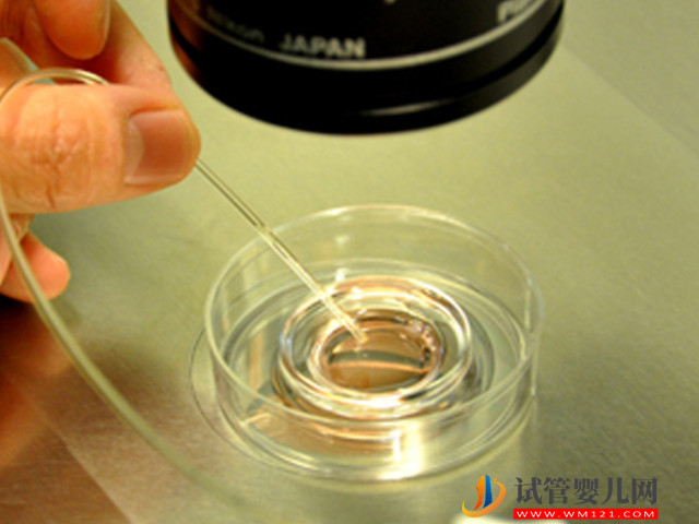 2023澳門人工授精最新價格表，“包成功”套餐全面解讀！(圖6)