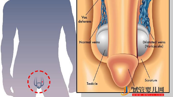 預(yù)防男人不育有哪幾個禁忌 預(yù)防男性不育應(yīng)牢記5個禁忌(圖1) 預(yù)防男人不育有哪幾個禁忌 預(yù)防男性不育應(yīng)牢記5個禁忌(圖1)