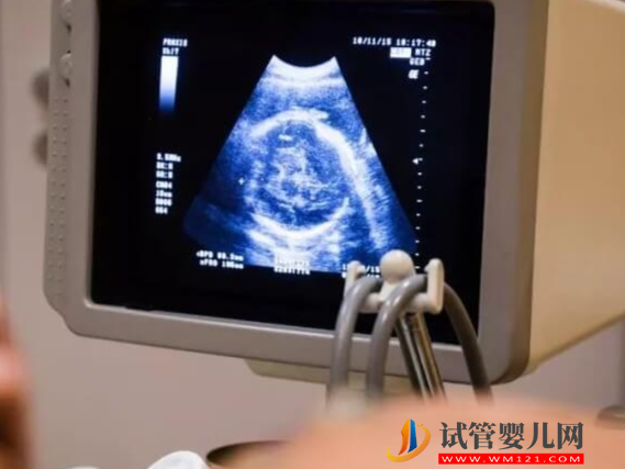 羊穿查出胚胎2號染色體基因突變會有哪些不良癥狀？(圖1)