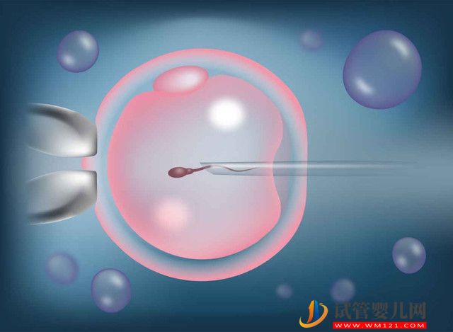 三代試管嬰兒精卵結(jié)合流程解析，具體過(guò)程分為這幾步(圖1)