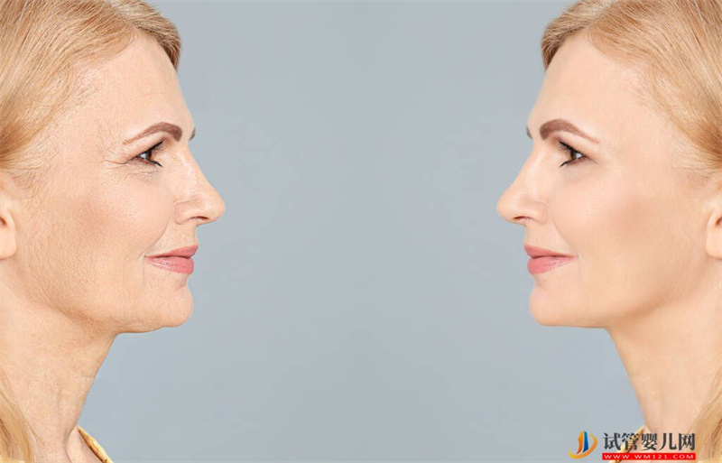 女性衰老有兩個加速點(圖1)