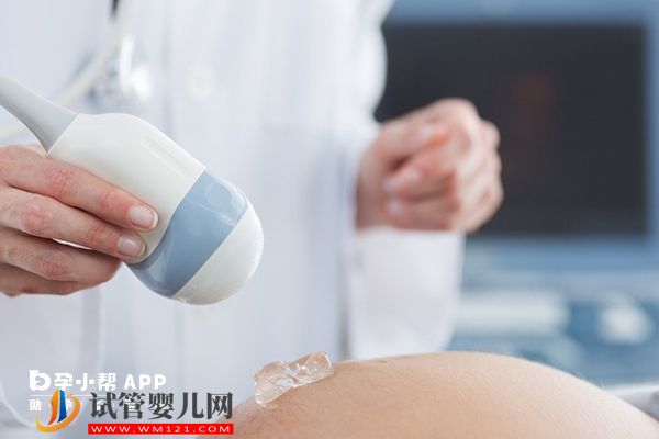 14號染色體異常跟男方有關(guān)系，做三代試管可生健康寶寶(圖1)