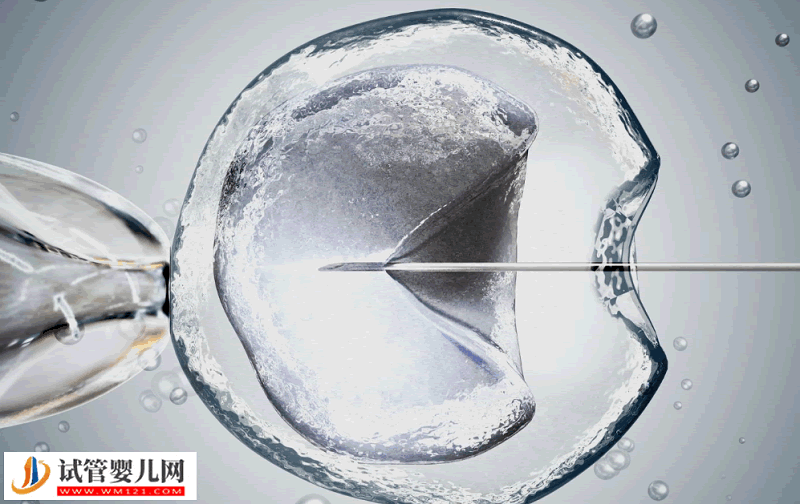 做一次試管嬰兒需要多少錢？，試管嬰兒的費用計算(圖1)