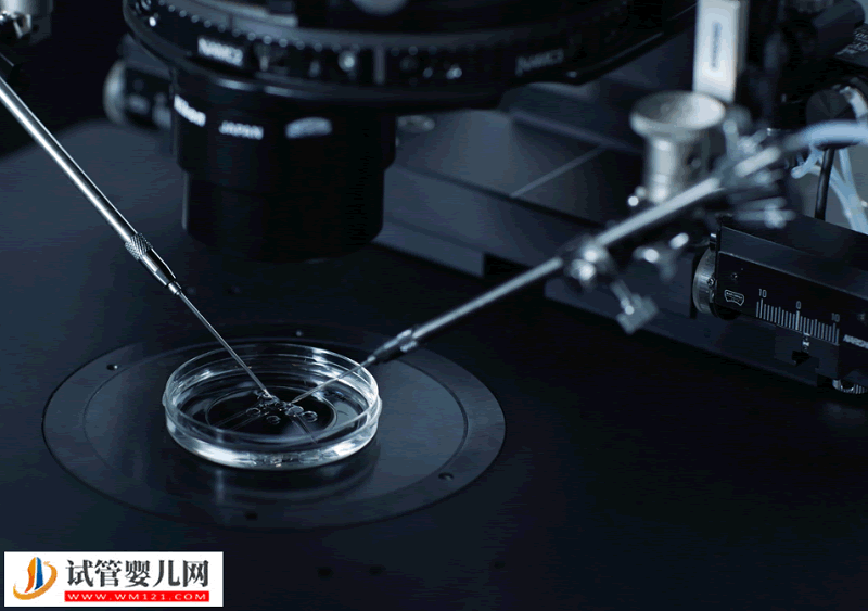 做試管嬰兒雌二醇多少算正常？(圖1)