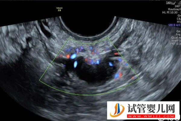 取卵后醫(yī)生說(shuō)下個(gè)月移植是什么意思，是不是懷孕瞧完清楚(圖3)