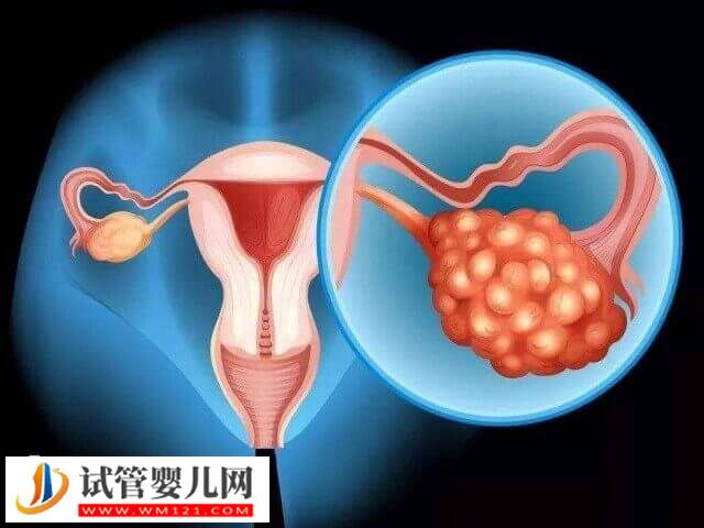 多囊促排卵泡不破解決方法是什么(圖1)