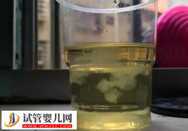 懷孕50天測男女土方法，酒精加尿液的酸堿度可以判斷(圖2)