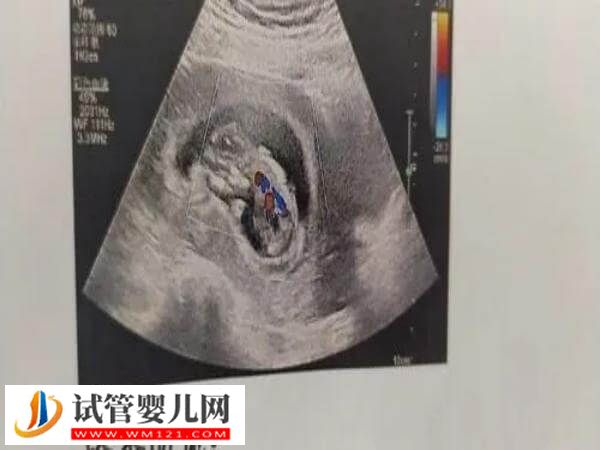 唐山做人工授精有哪些步驟(圖1)