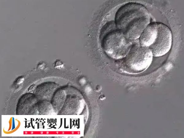 夫妻在茂名人民醫(yī)院移植哪種胚胎好(圖1) 夫妻在茂名人民醫(yī)院移植哪種胚胎好(圖1)