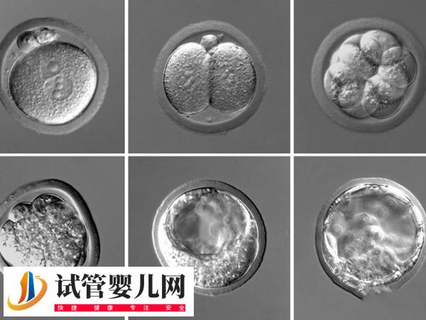 在美國做試管優(yōu)質(zhì)胚胎是啥樣的(圖3)