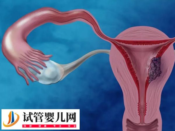 攀枝花試管醫(yī)院哪家好(圖2) 攀枝花試管醫(yī)院哪家好(圖2)