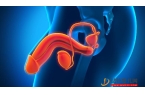 男性陰莖中線囊腫是怎么回事 男性陰莖中線囊腫的